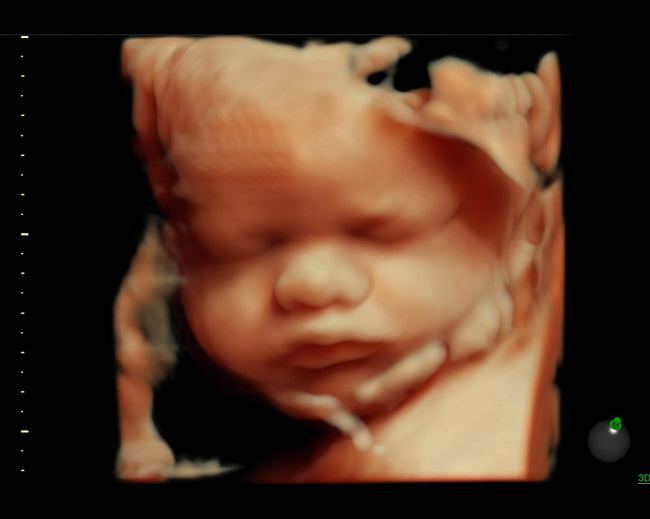 Hdlive-36-week-fetus
